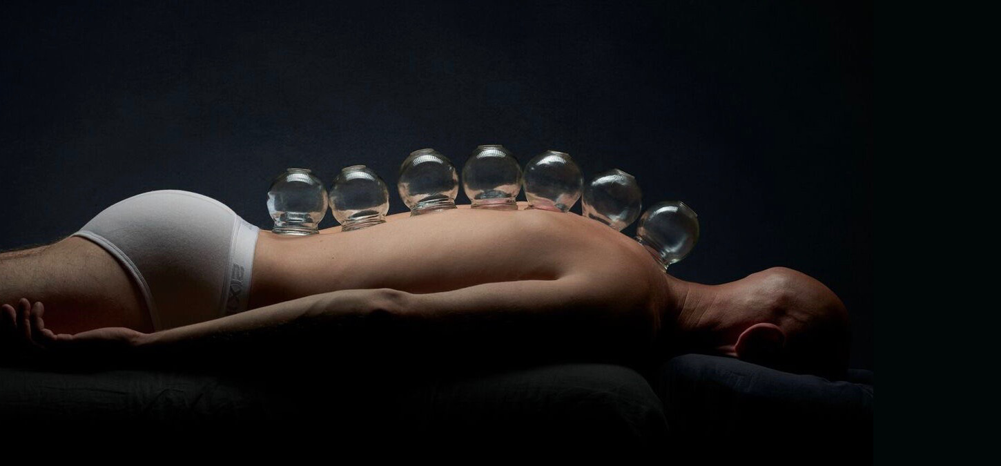 Find out what chinese cupping can do for you